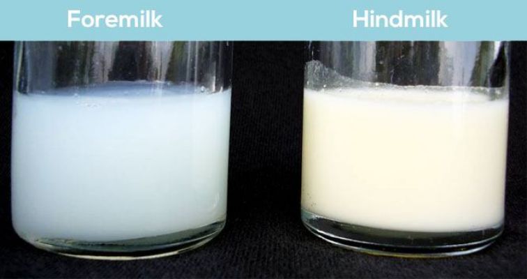 Foremilk and hindmilk imbalance and its effect on poop frequency