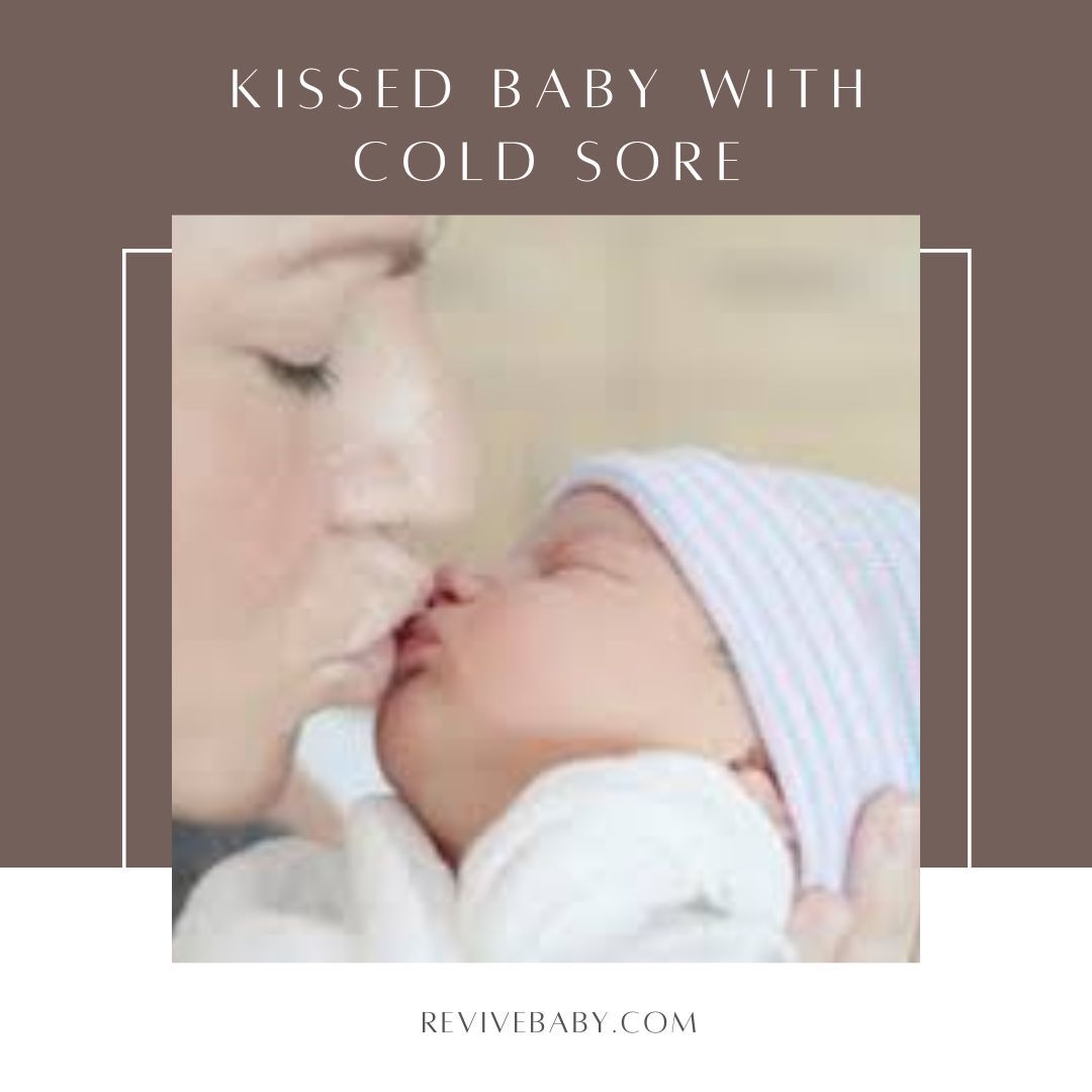 Kissed baby with cold sore
